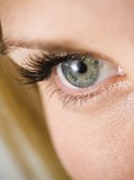 Beautiful eyes need nice regular eyelids, not droopy heavy lateral parts. Surgery can correct that and restore youthful looks.